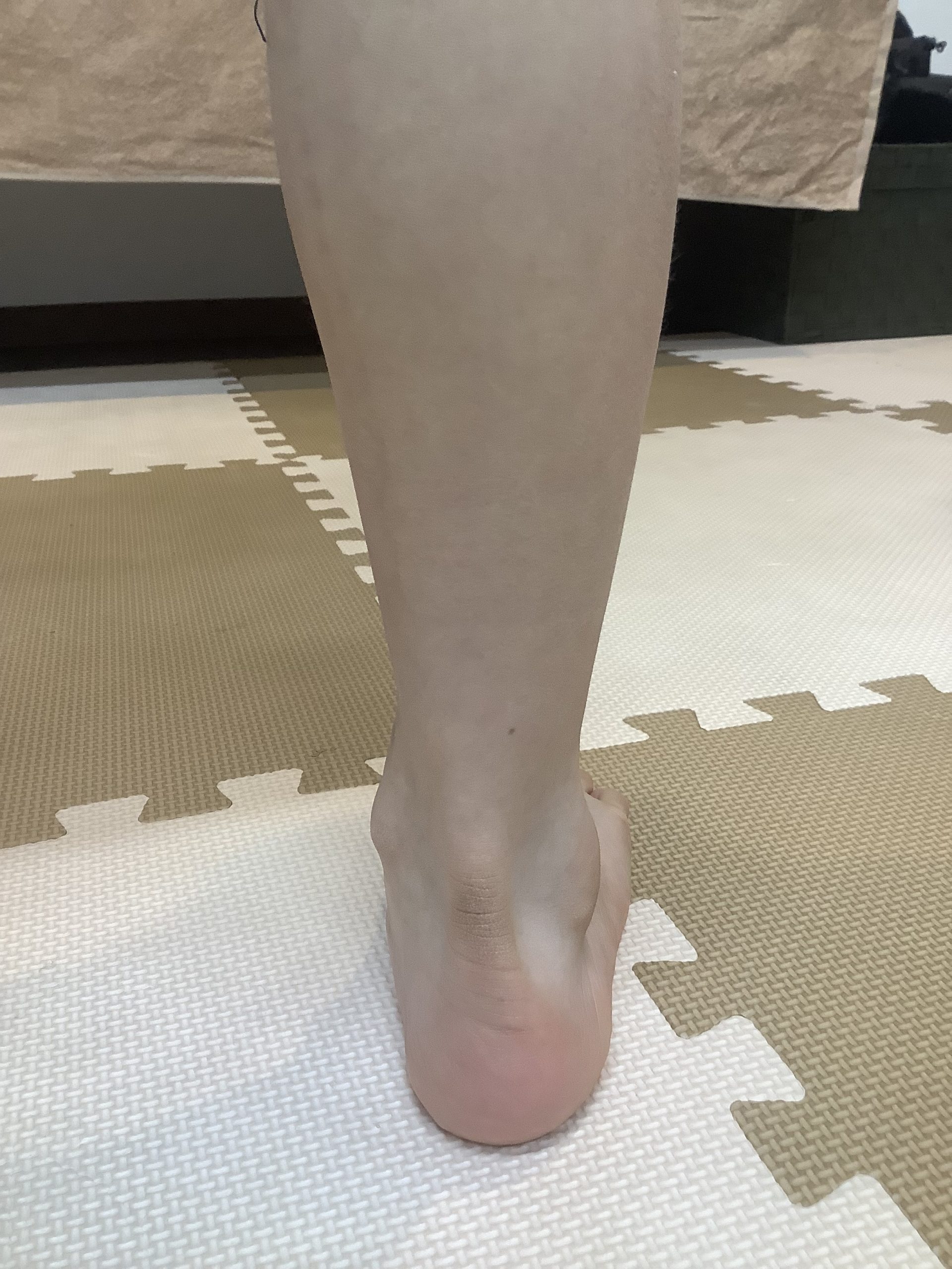 裸足で足首が内側に倒れた状態