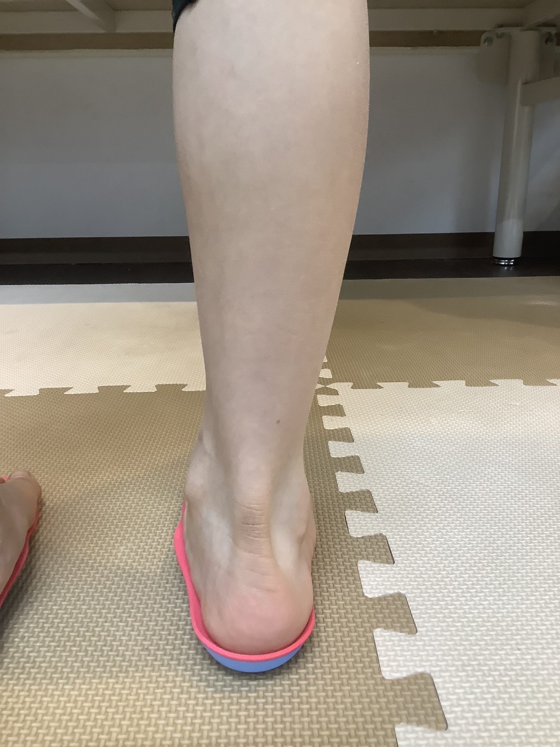 インソールで足首の軸が整った状態
